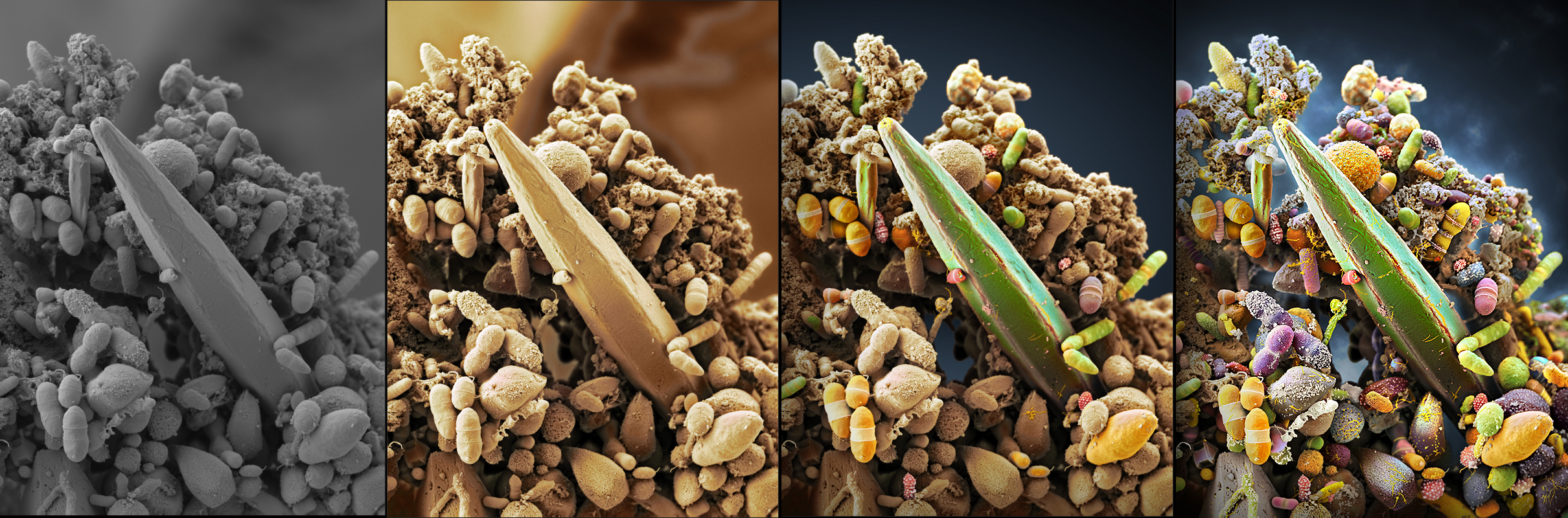 Face of Feces - The Human Microbiome